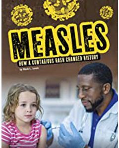 Measles